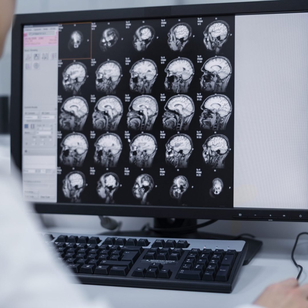 doctor-looking-ct-scan